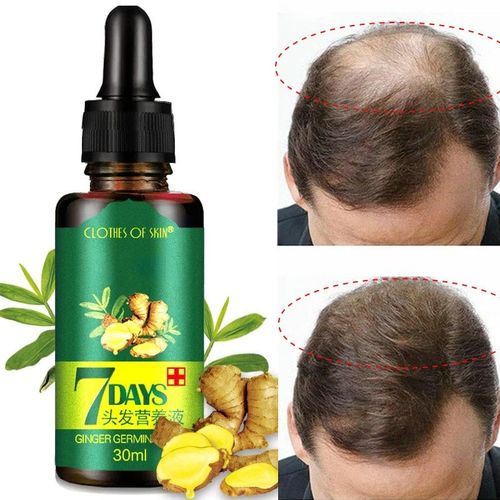 Ginger Oil - Hair Regrowth Serum 30ml