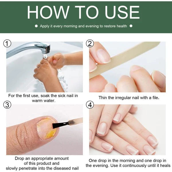 Nail Fungus Treatment