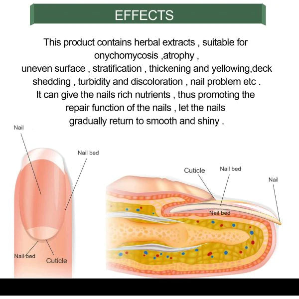 Nail Fungus Treatment